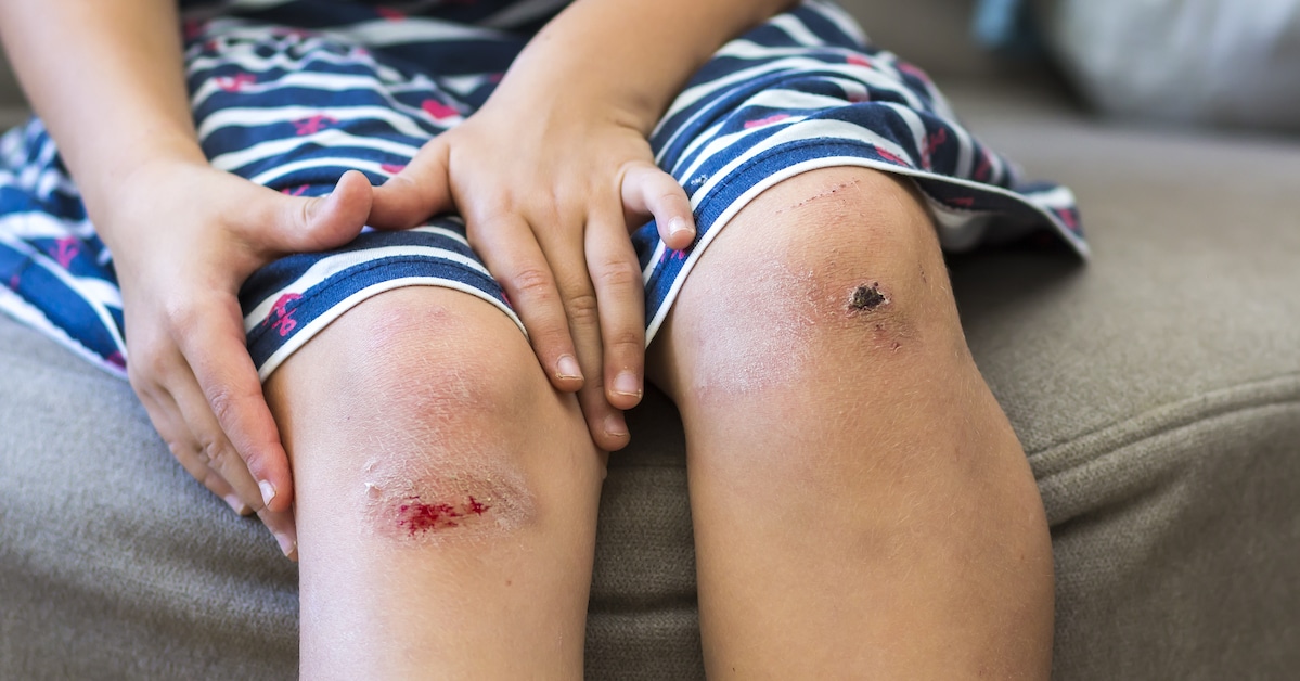 close-up-little-girl-holding-her-bruised-injured-damaged-knee-with-her-hands