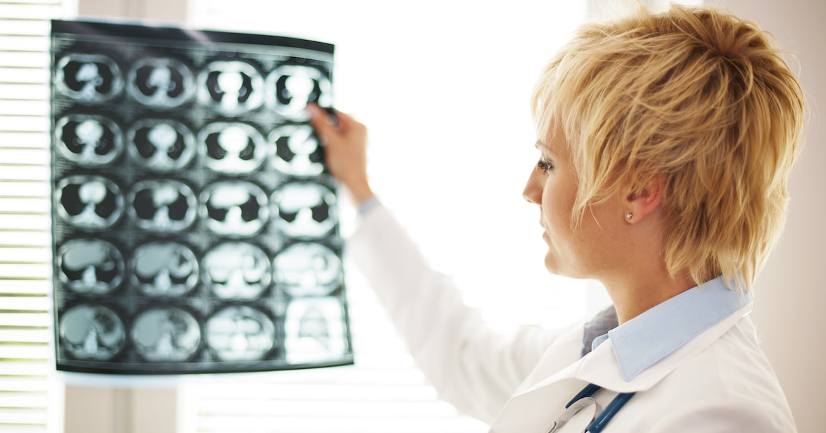 specialist-checking-brain-tomography-results
