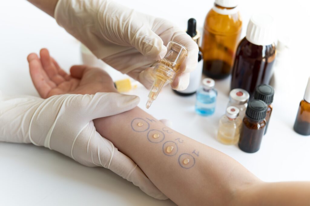skin-allergy-reaction-test-person-s-arm-1024x681